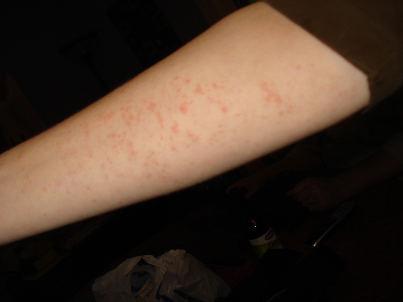 Small, itchy bumps on forearm (rash?) - Dermatology - MedHelp